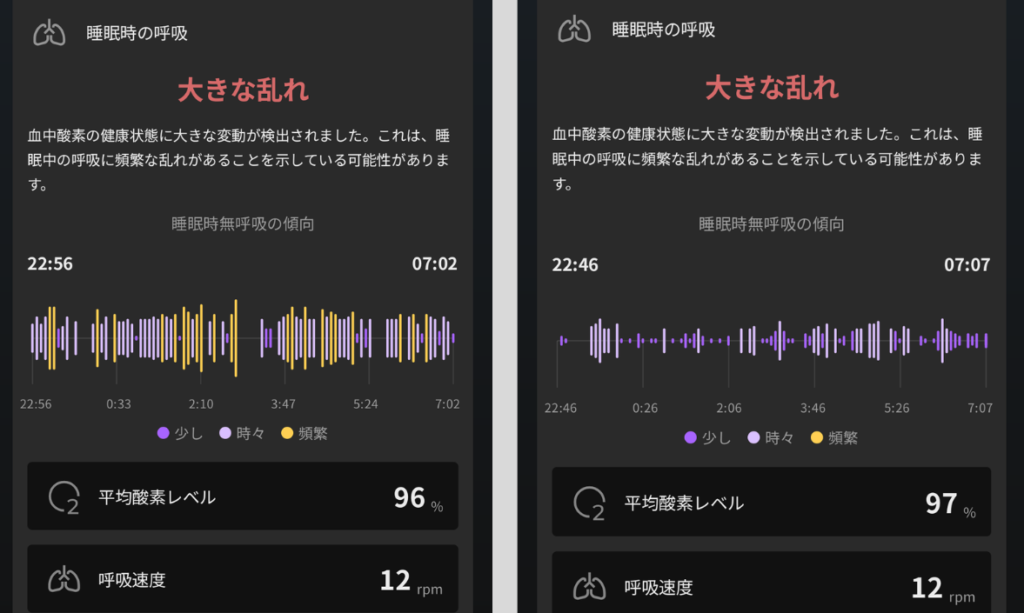 SOXAI RINGの睡眠時無呼吸症候群の結果