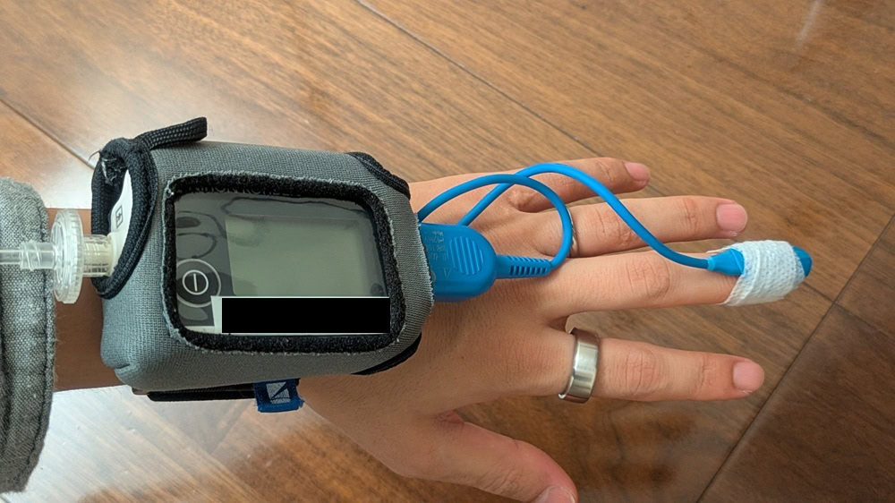 睡眠時無呼吸症候群の検査